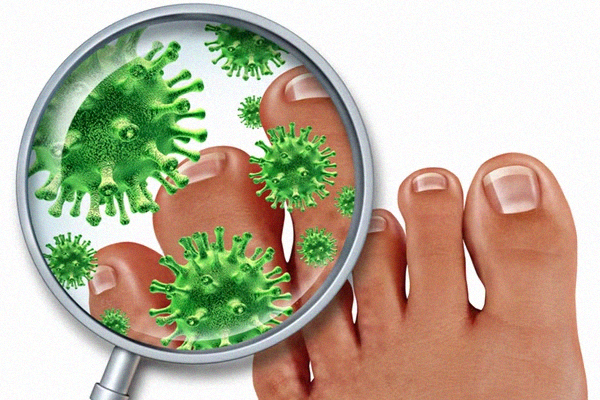 Dipirona sobre as unhas mata micose e fungos